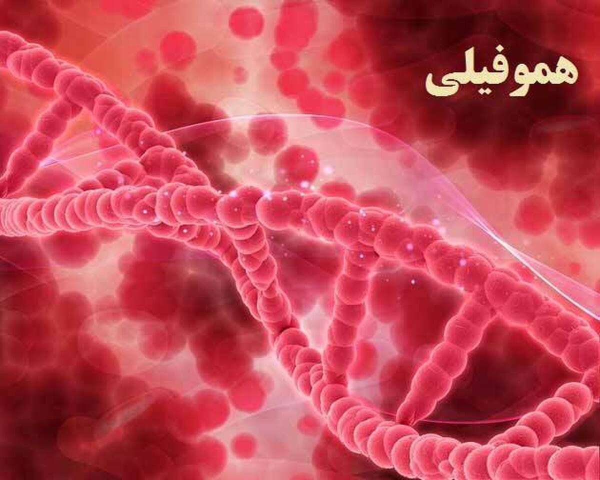 علت ابتلا به بیماری هموفیلی چیست؟