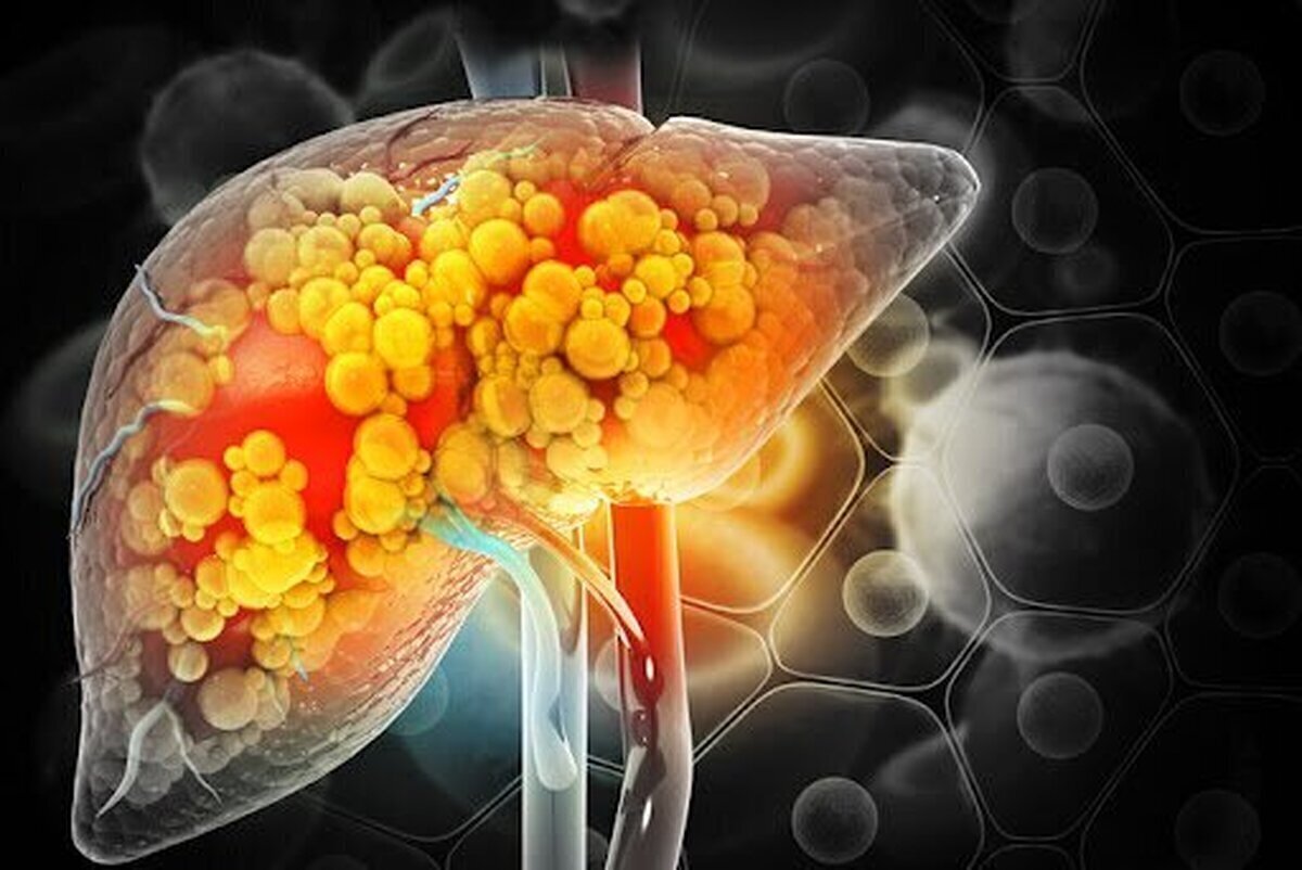 کاهش سطح کلسترول LDL مفید برای قلب!