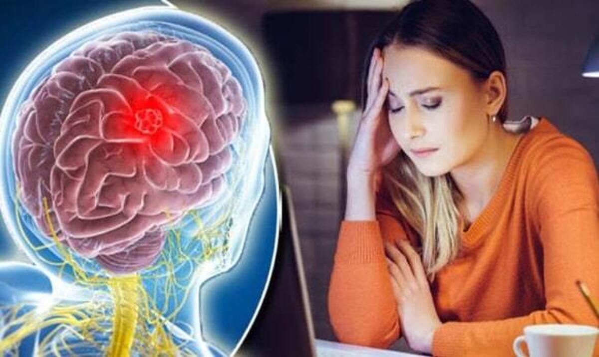 چه زمانی سردرد نشانه تومور مغزی است؟
