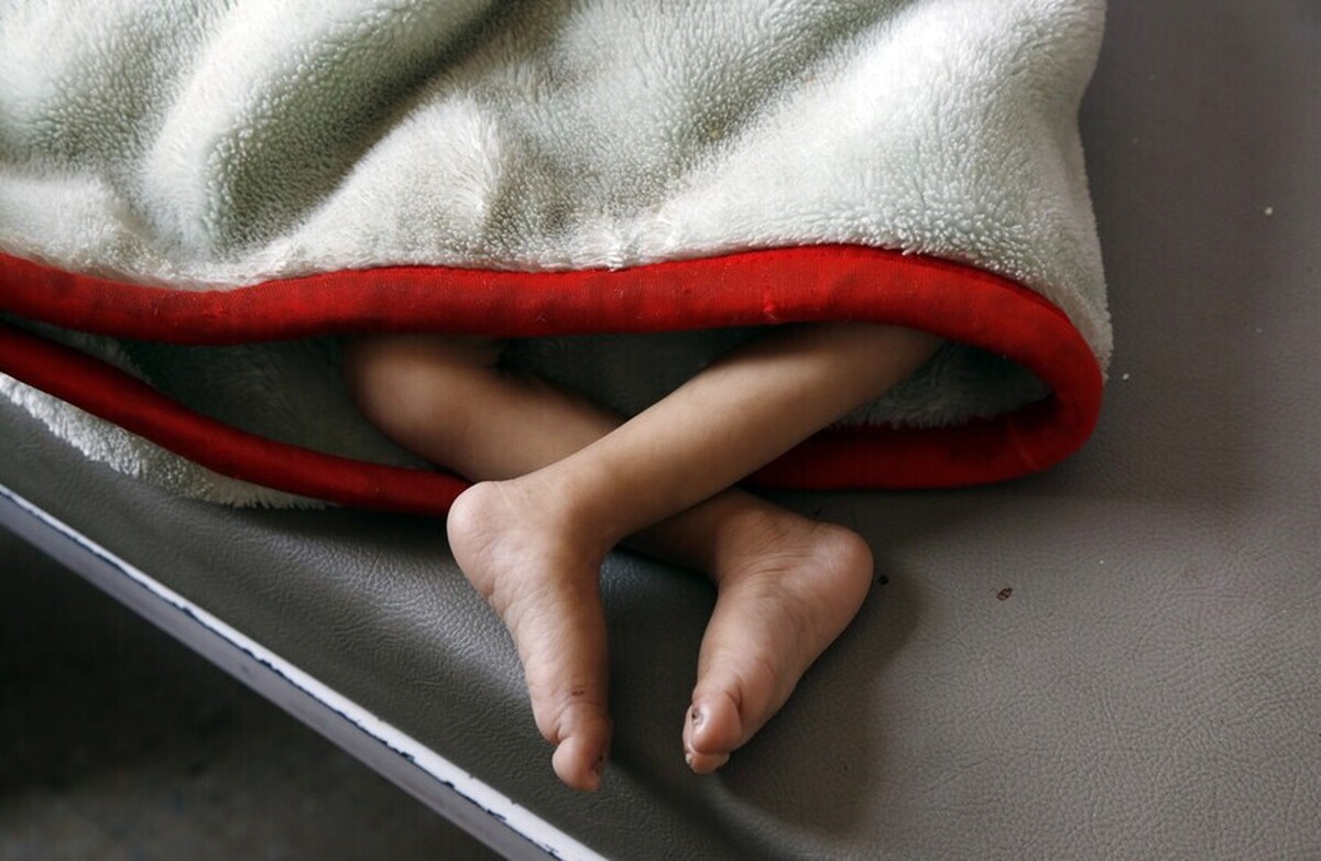 سازمان ملل: نیمی از کودکان یمن به شدت دچار سوء تغذیه هستند