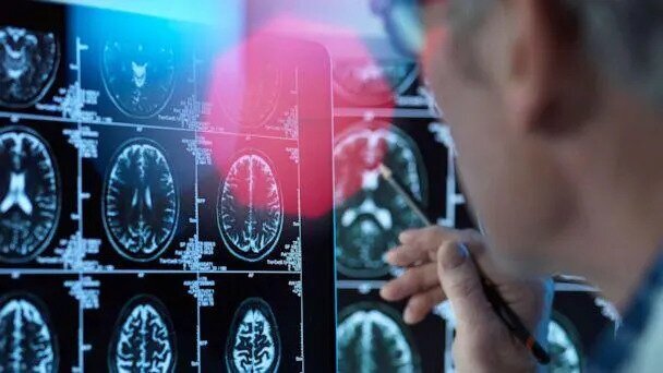 آیا ریلز‌های کوتاه اینستاگرام مغز شما را دچار اختلال می‌کند؟