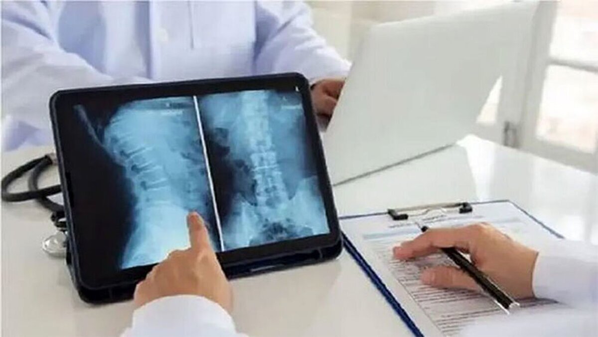 سلول بنیادی عصبی میتواند بیماران دچار فلج را درمان کند؟