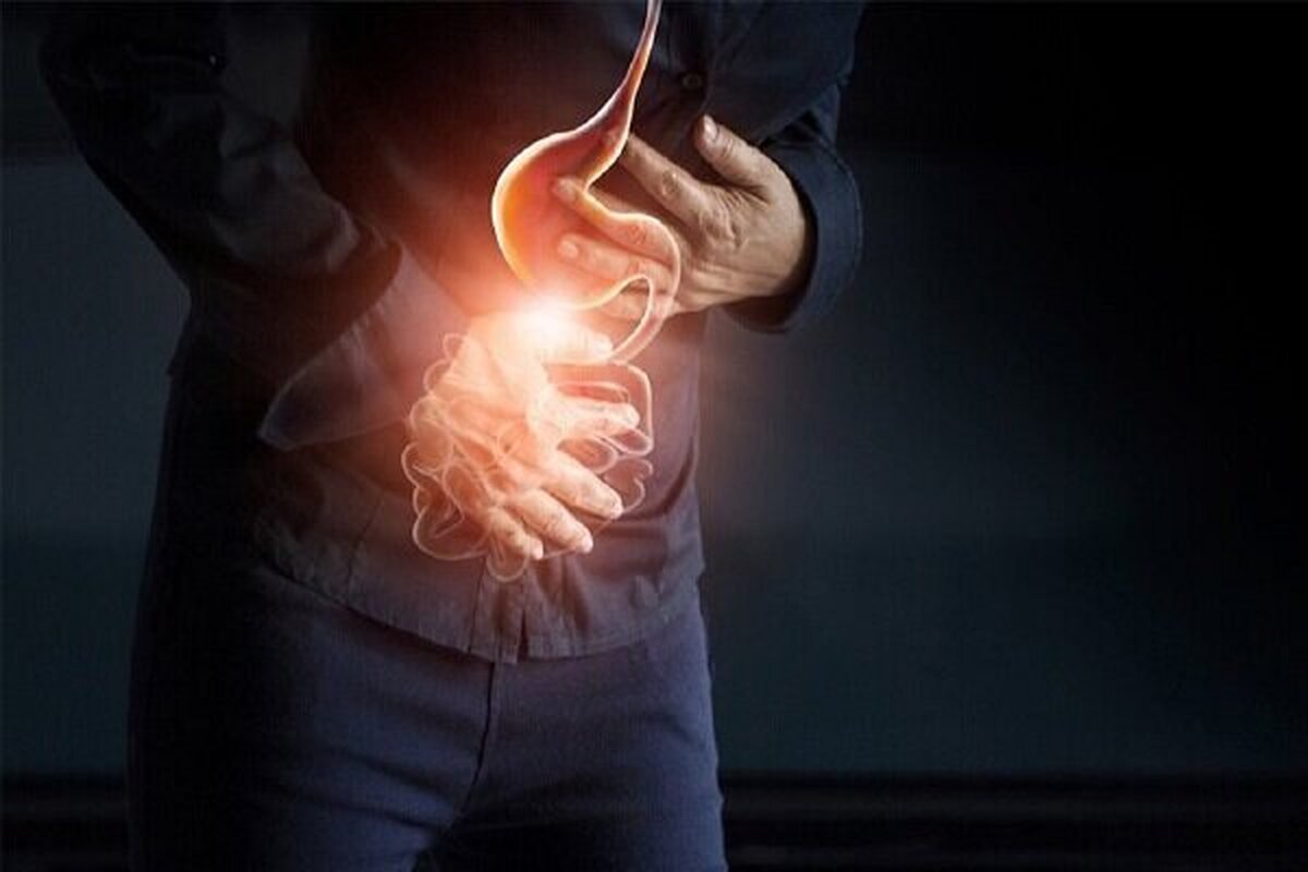 رفلاکس معده عاملی برای ابتلا به التهاب مری!