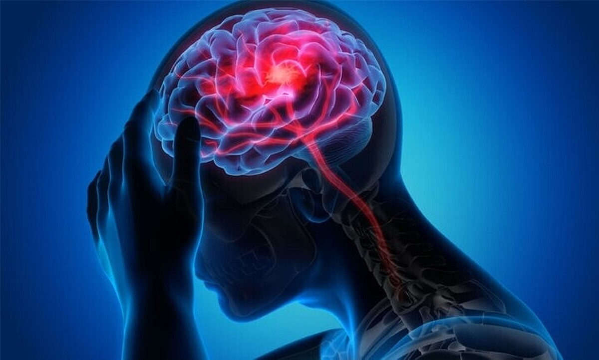 بیماری‌های مغزی عامل مشترک دارند!