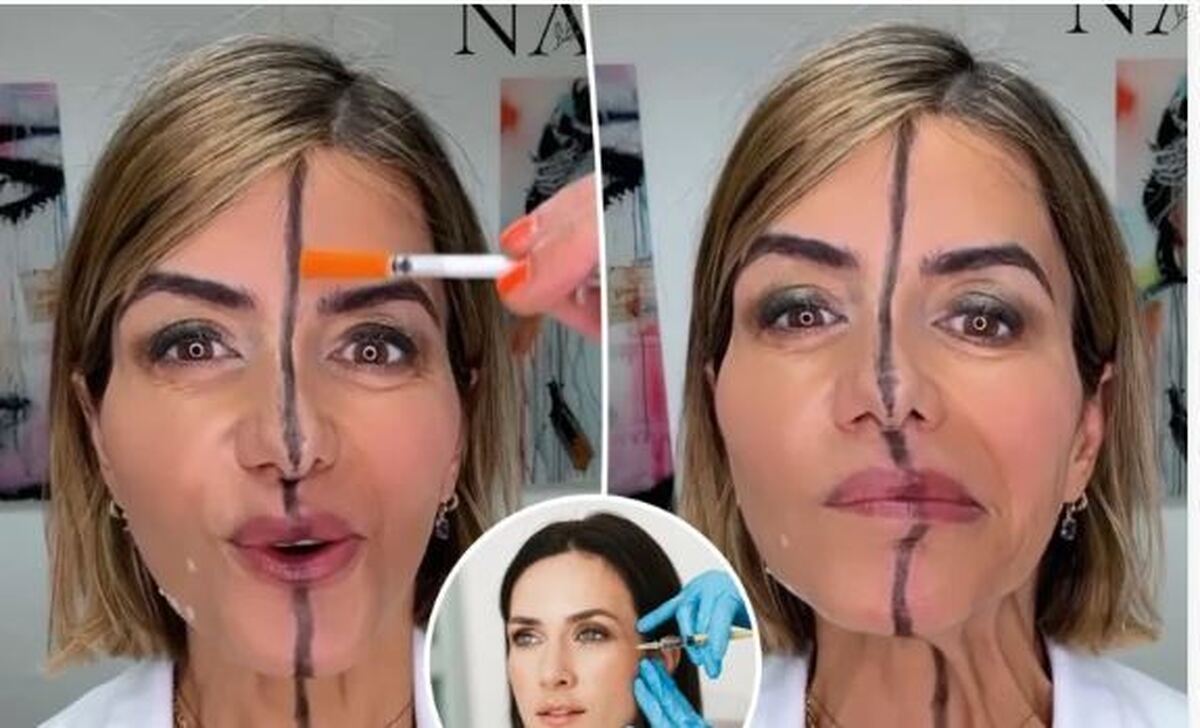 تفاوت چهره بعد از بوتاکس در یک آزمایش عجیب