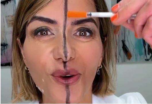 تفاوت چهره بعد از بوتاکس در یک آزمایش عجیب