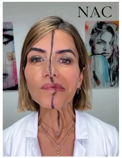 تفاوت چهره بعد از بوتاکس در یک آزمایش عجیب