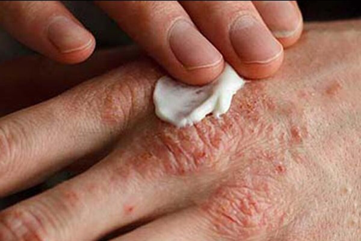 شایع‌ترین مشکلات پوستی کدامند؟