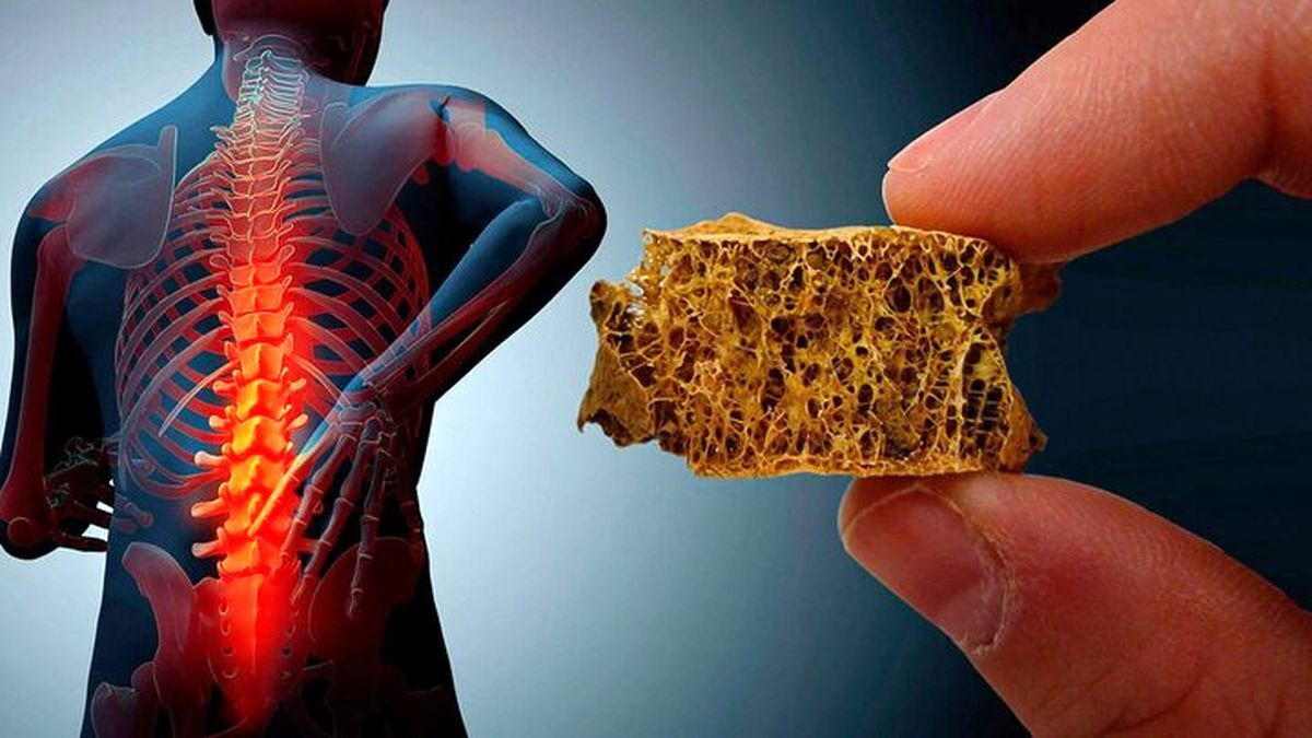 چگونه ویتامین D جذب کنیم؟