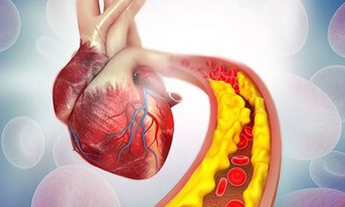 با این کار‌ها به سادگی سطح کلسترول خون را کنترل کنید