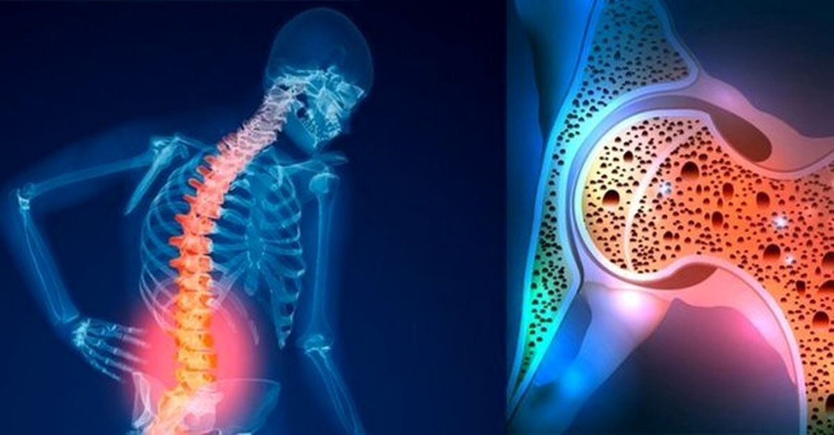 آیا می‌دانستید ویتامین A در سلامت استخوان‌ها نقش حیاتی ایفا می‌کند؟