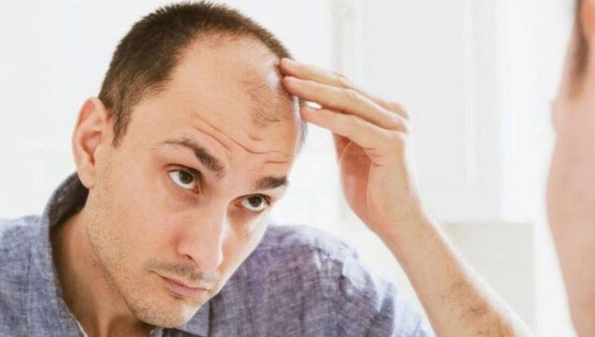 فکت‌های علمی در مورد ریزش مو که تا کنون نمی‌دانستید