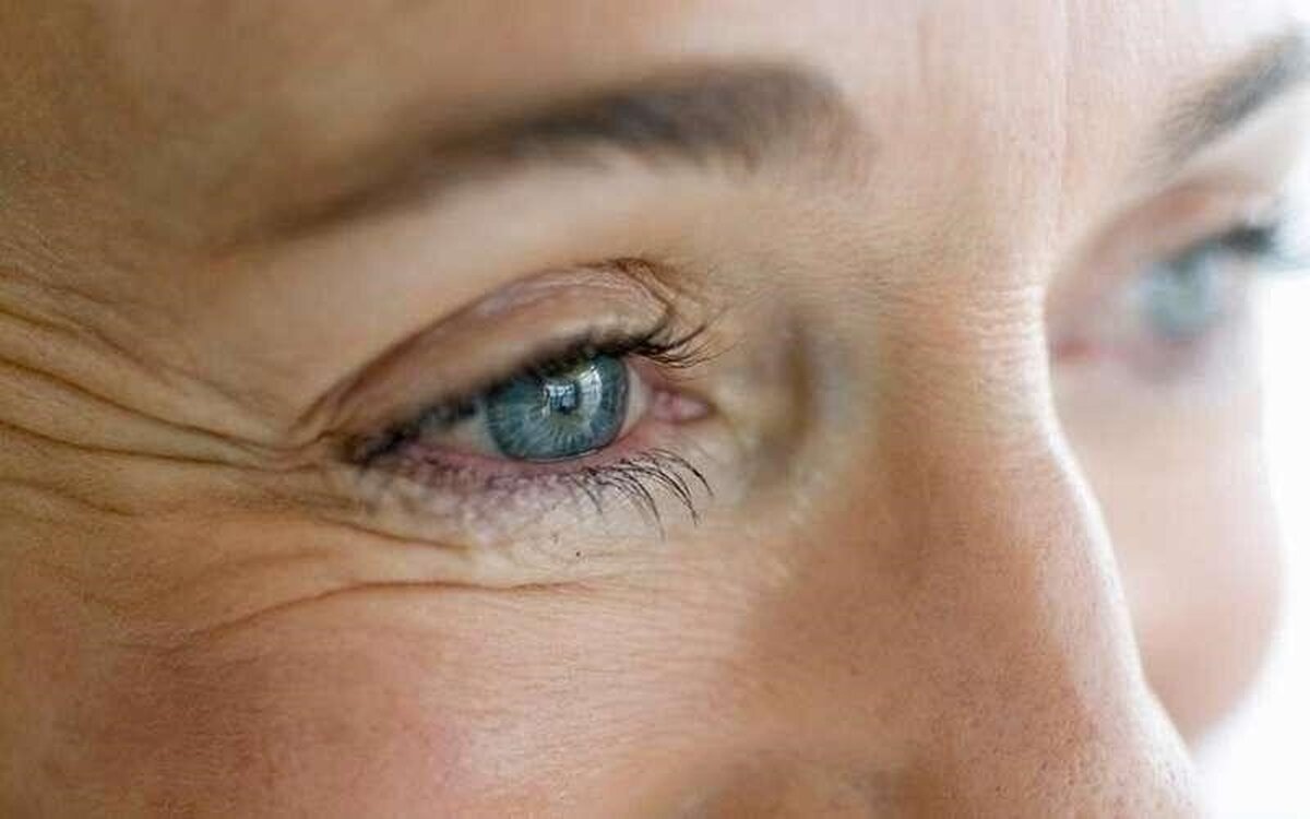 از یوگای صورت تا خواب کافی/روش‌هایی برای از بین بردن چین و چروک صورت