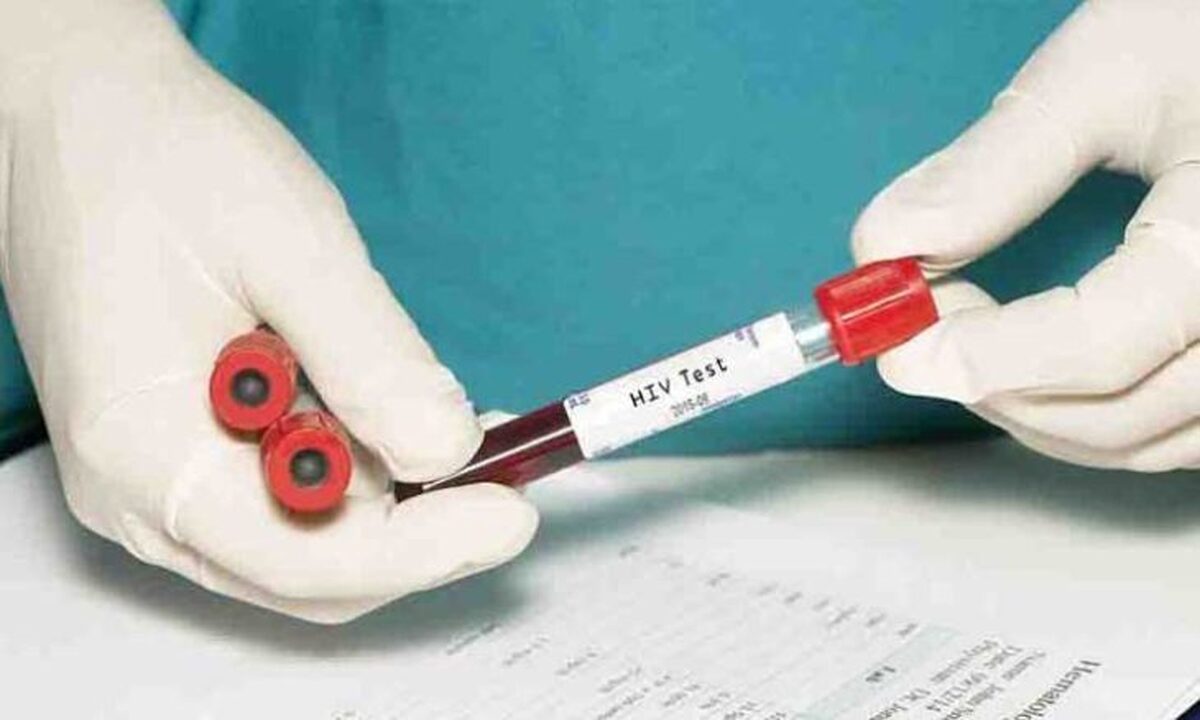 سازمان ملل: پایان دادن به ایدز تا سال ۲۰۳۰ هنوز امکان‌پذیر است