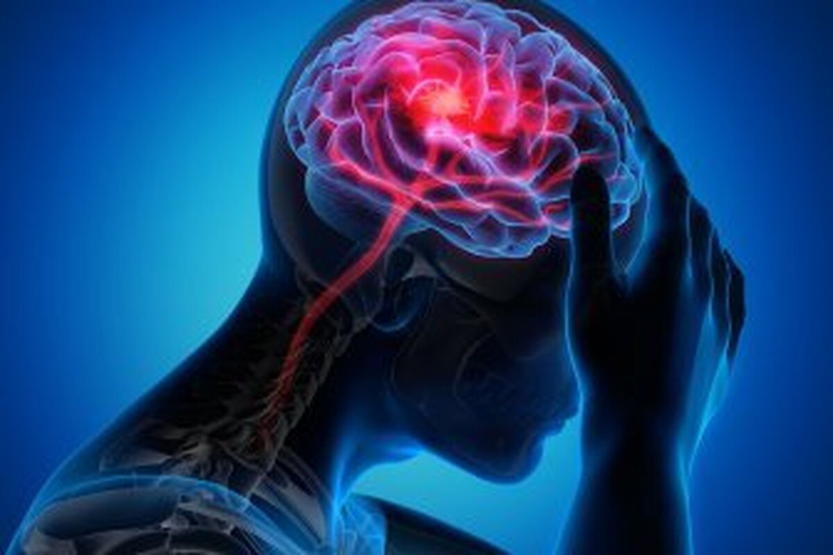 خطر سکته مغزی تا یک دهه پس از سکته مغزی خفیف افزایش می‌یابد