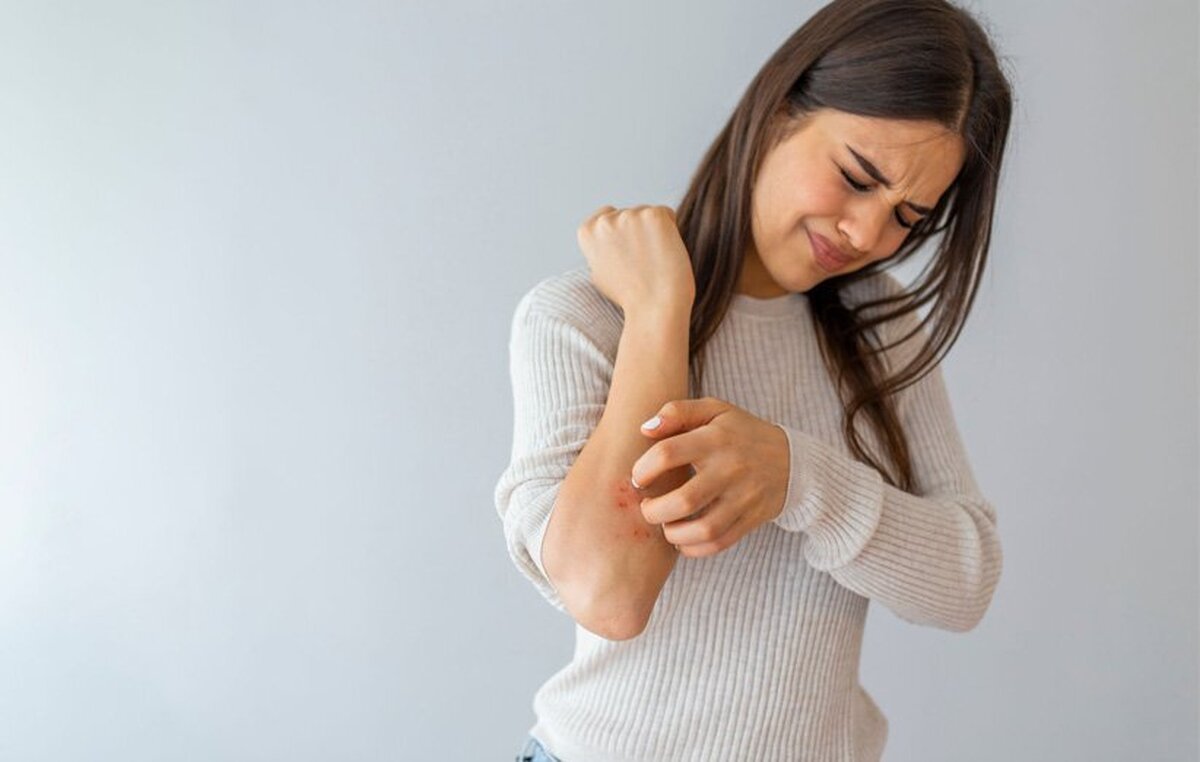 خارش: انواع، علل و ۷ نکته برای مقابله با آن