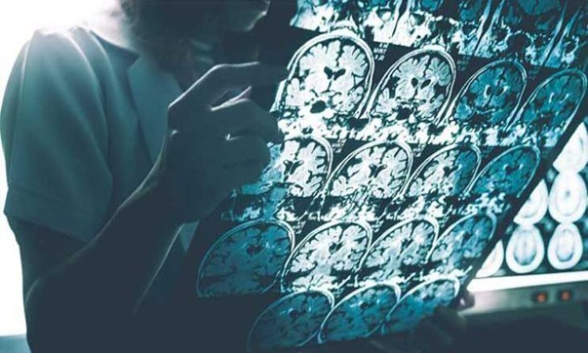 مطالعه‌ای آلزایمر را با کمبود خواب مرتبط می‌داند
