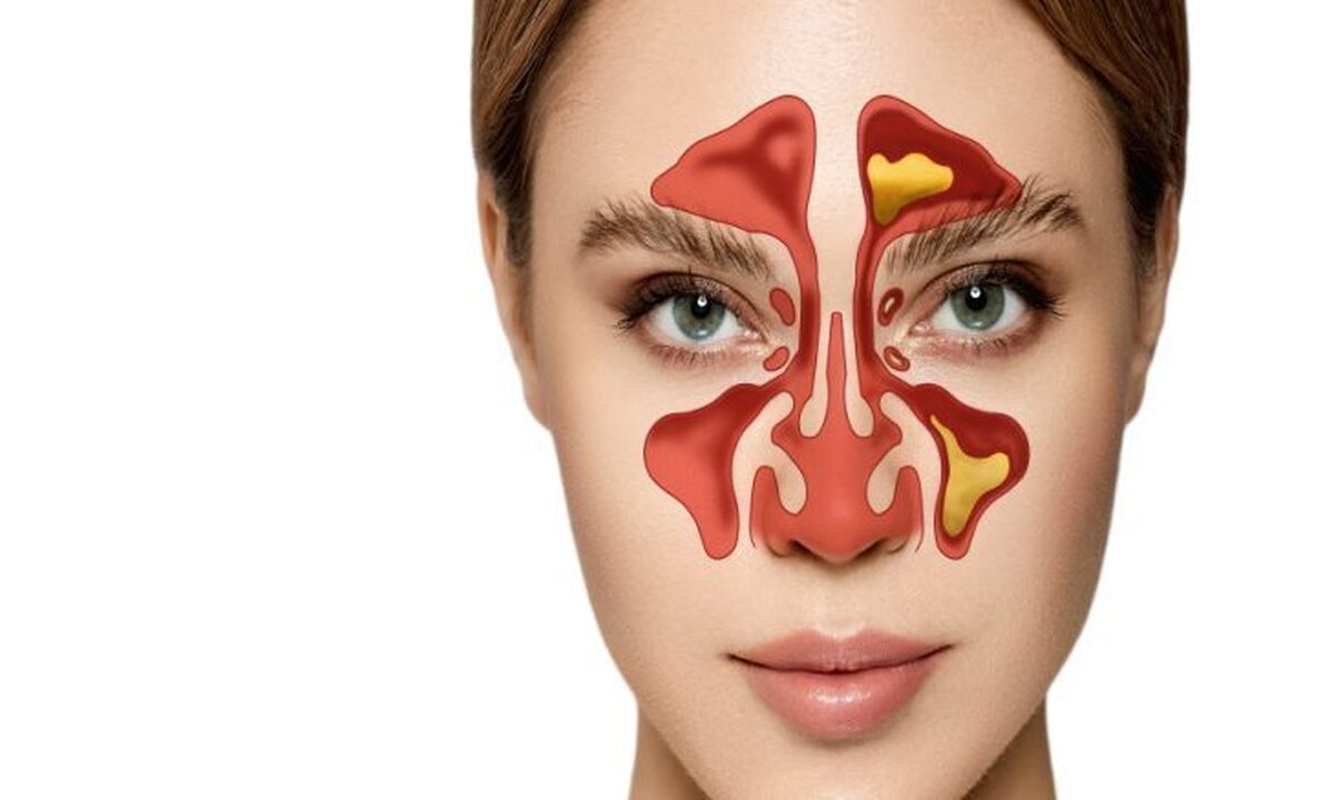 سینوس‌ها دریچه‌ای برای درک تکامل انسان هستند