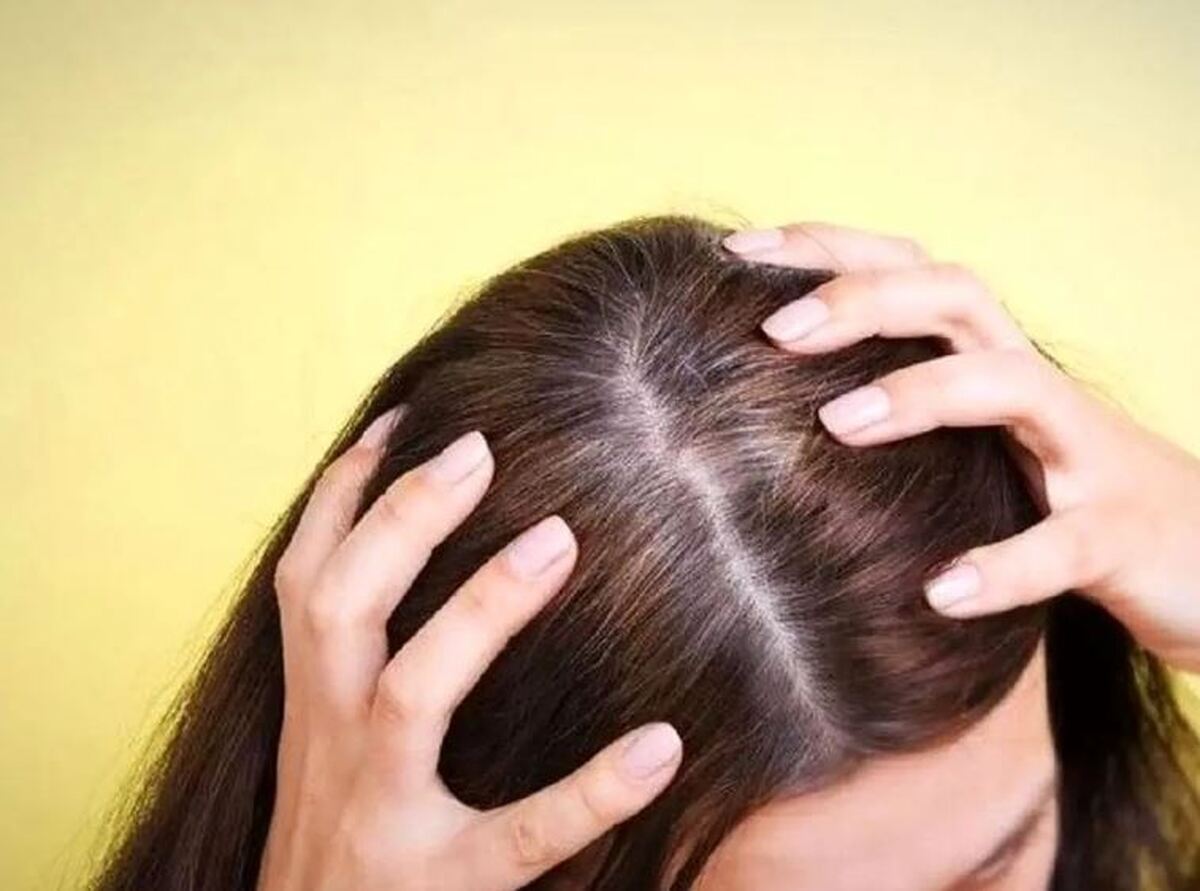 فکت‌های علمی در مورد سفیدی مو که باید بدانید