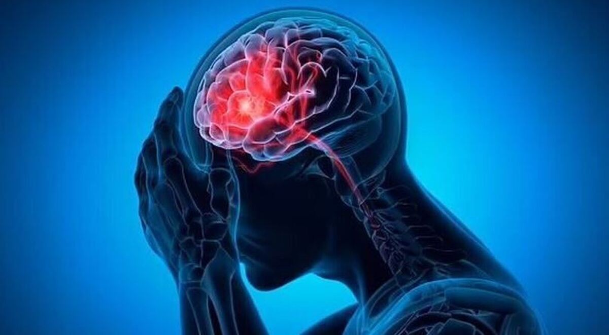 مبتلایان به این بیماری تا ۷۰ درصد بیشتر از سایر افراد در معرض سکته مغزی قرار دارند