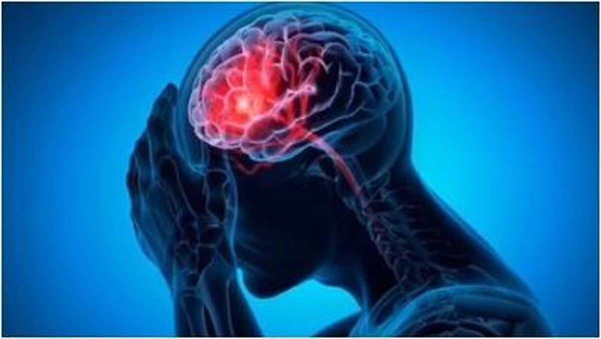خطر سکته مغزی بیشتر در کمین این افراد است!