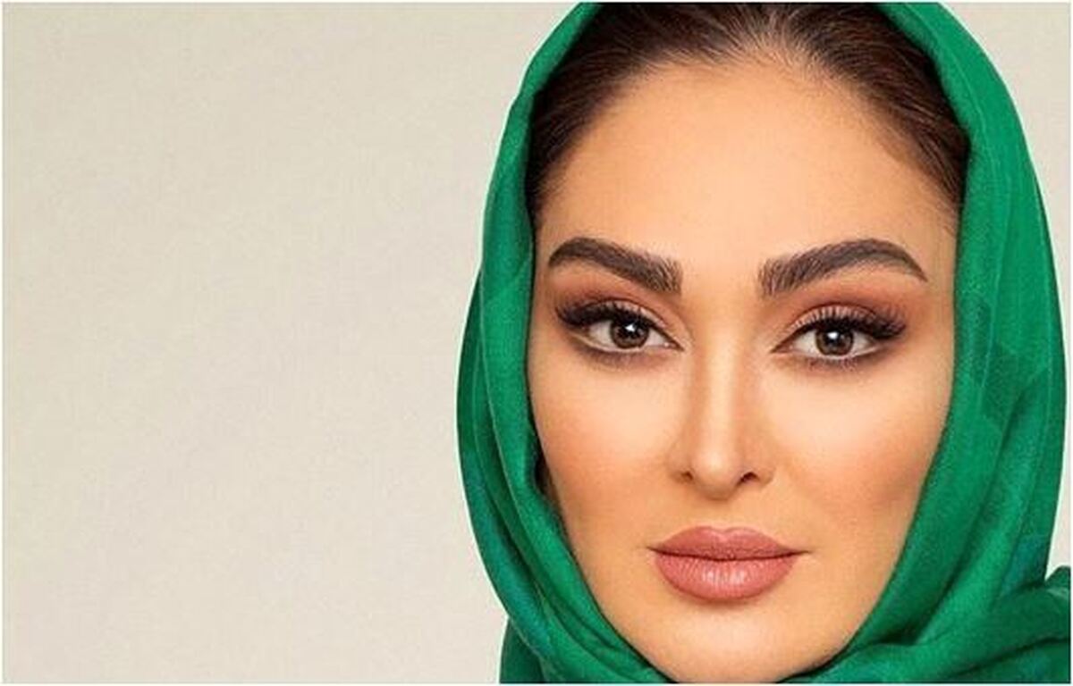 «الهام حمیدی و بهنوش طباطبایی» وقتی هنوز قربانی عمل‌های زیبایی نشده بودند! +عکس