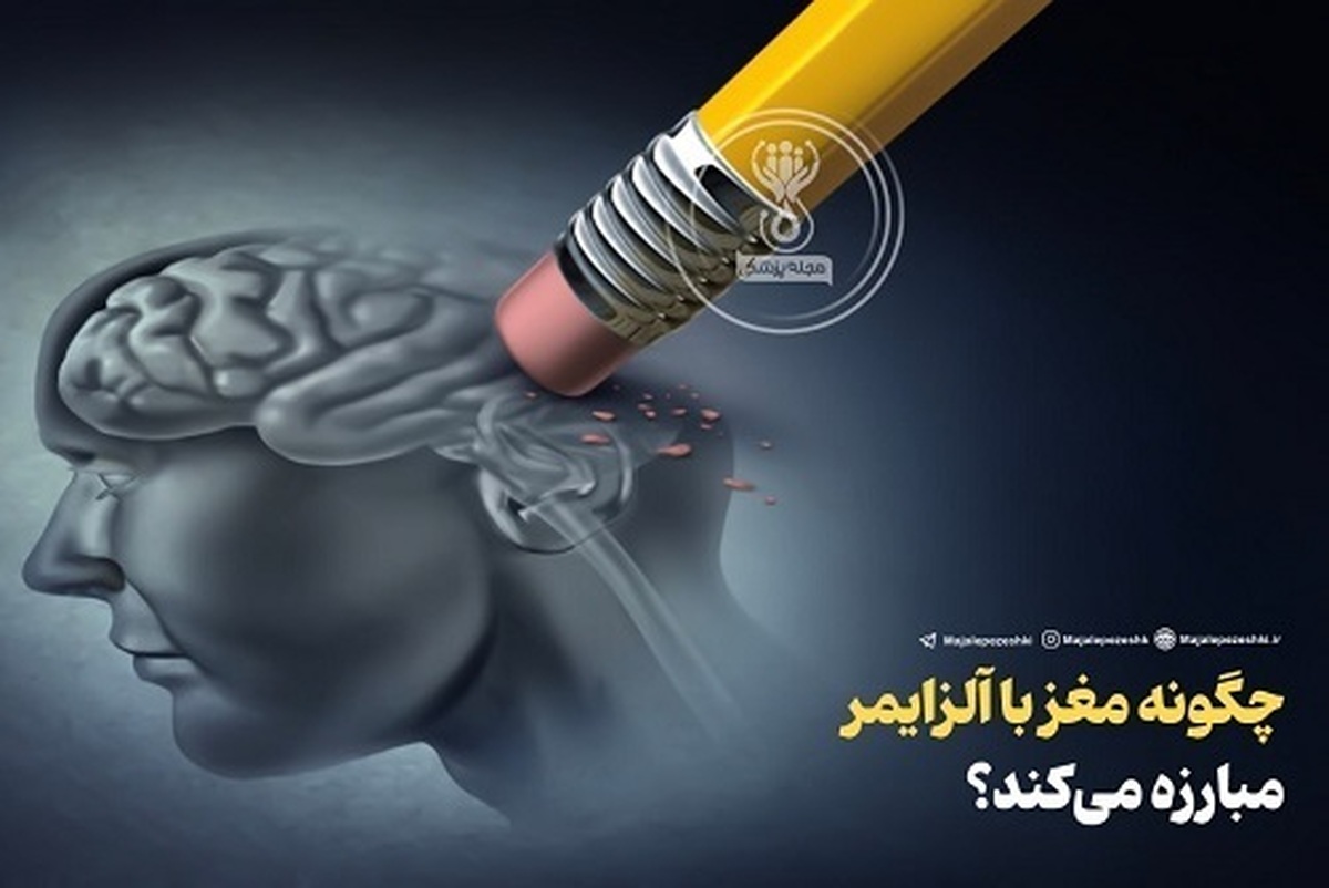 چگونه به مغز آموزش دهیم تا با آلزایمر مقابله کند؟
