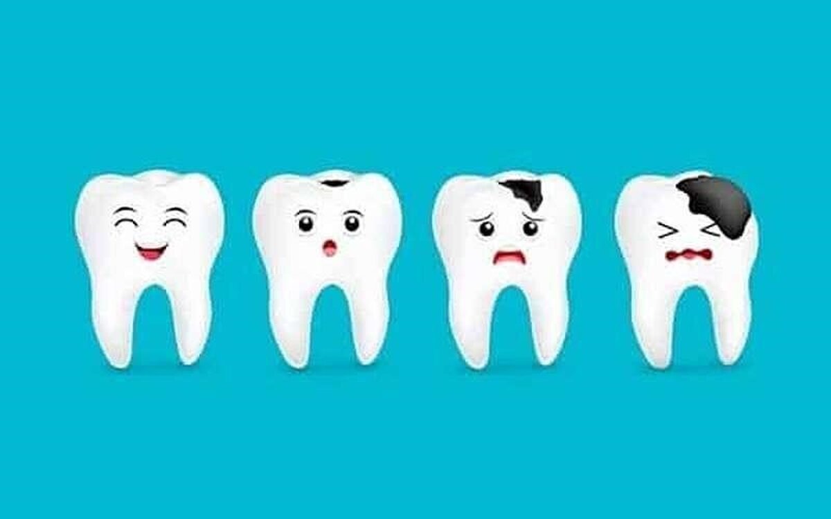 نکات مراقبتی از دندان‌ها برای داشتن لبخندی زیبا!