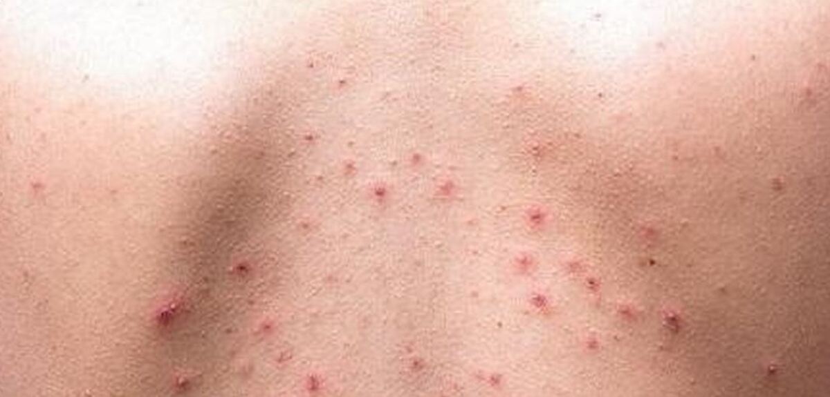 چگونه مشکلات پوستی را شناسایی و درمان کنیم؟