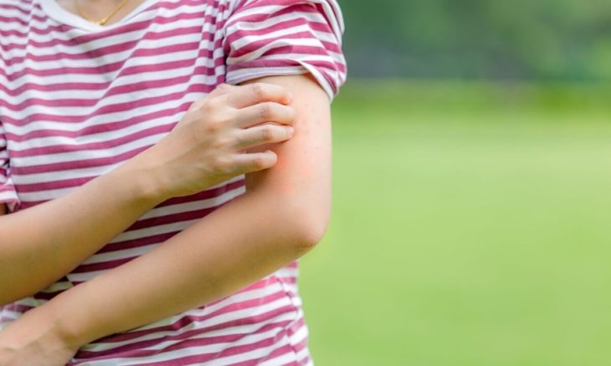 پشه‌ها چگونه قربانیان خود را انتخاب می‌کنند؟