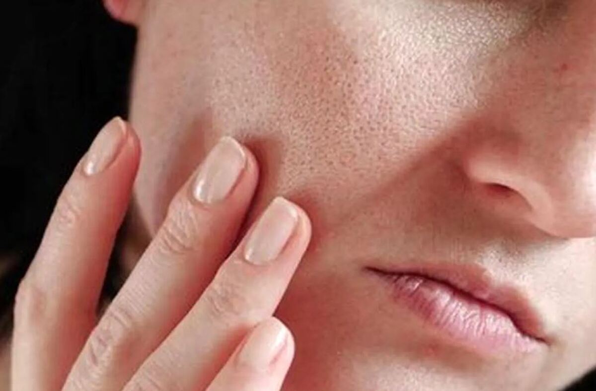 توصیه‌های تغذیه‌ای برای داشتن پوست و موی سالم