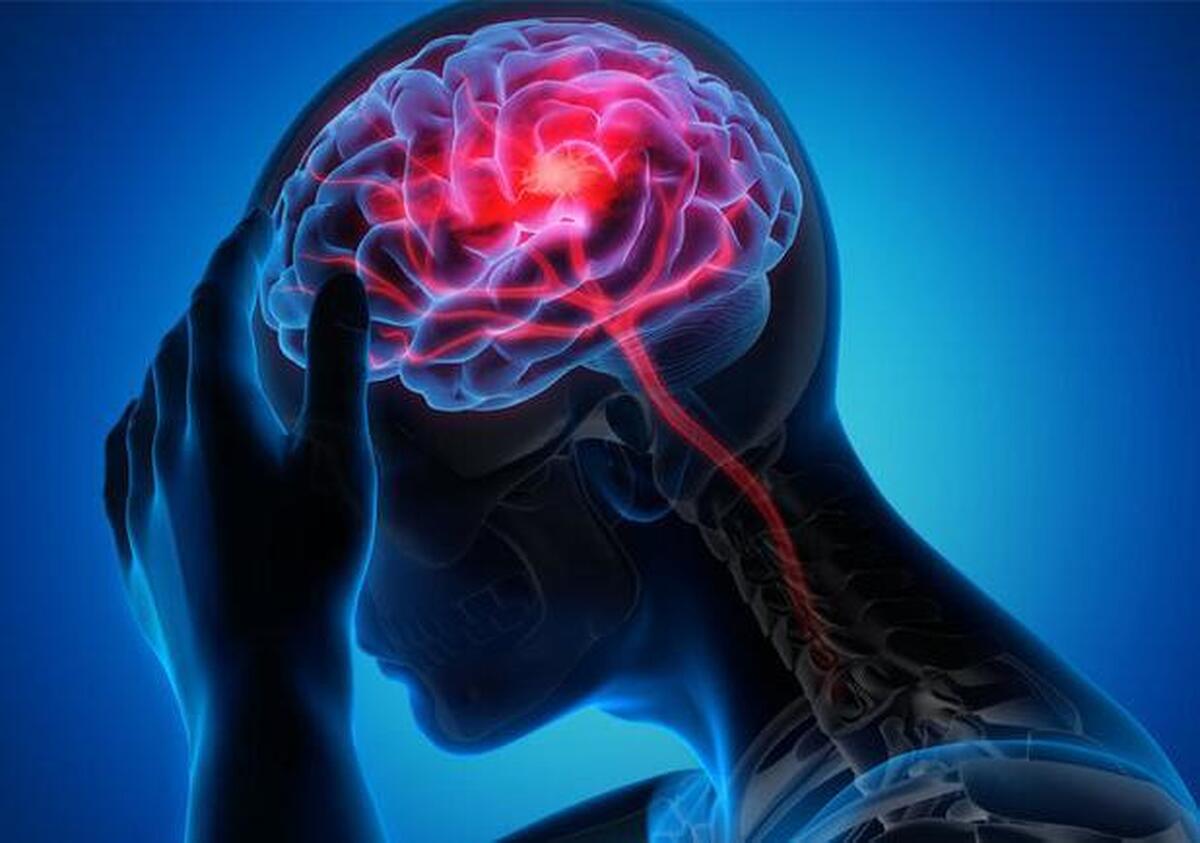 سکته مغزی خفیف تا یک سال بر فرد تاثیر دارد!