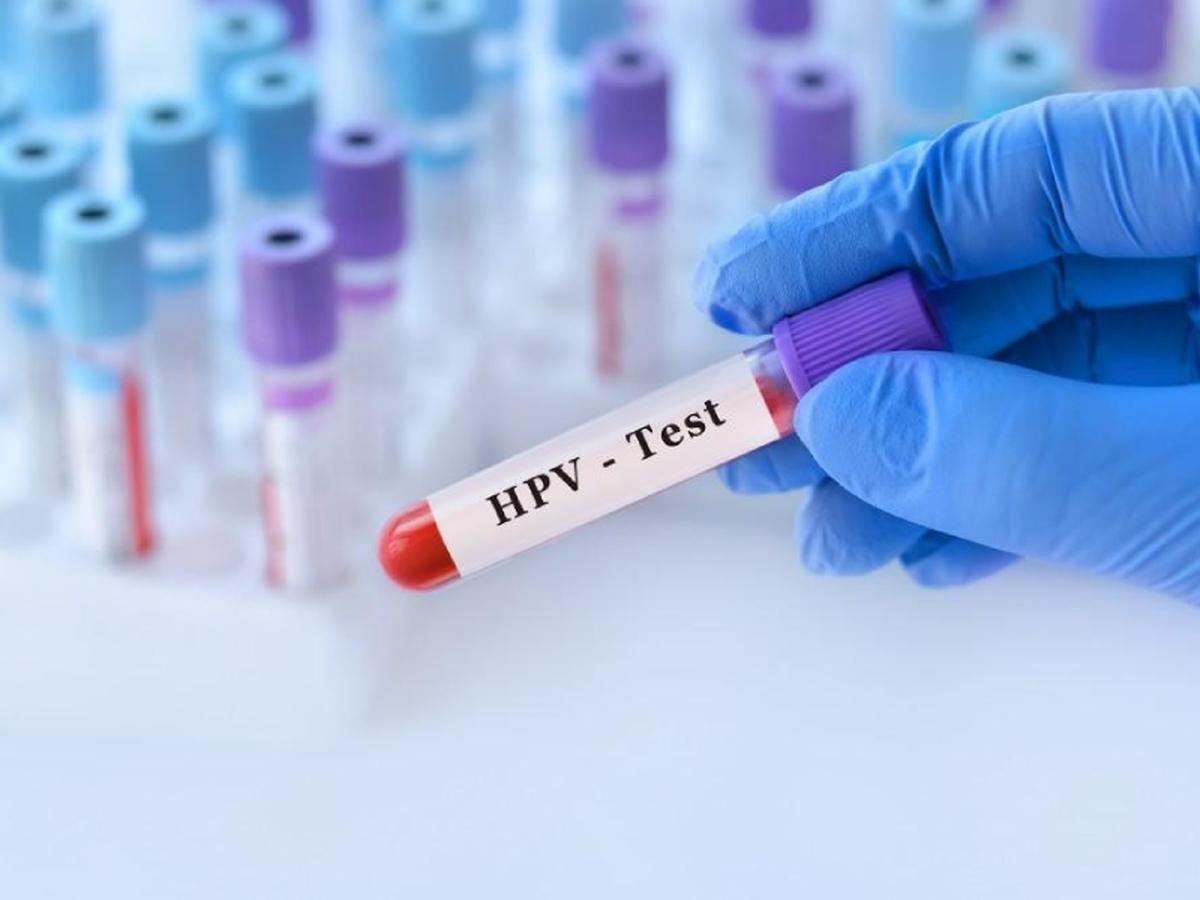 اطلاعات نادرست درباره ویروس HPV را بدانید!