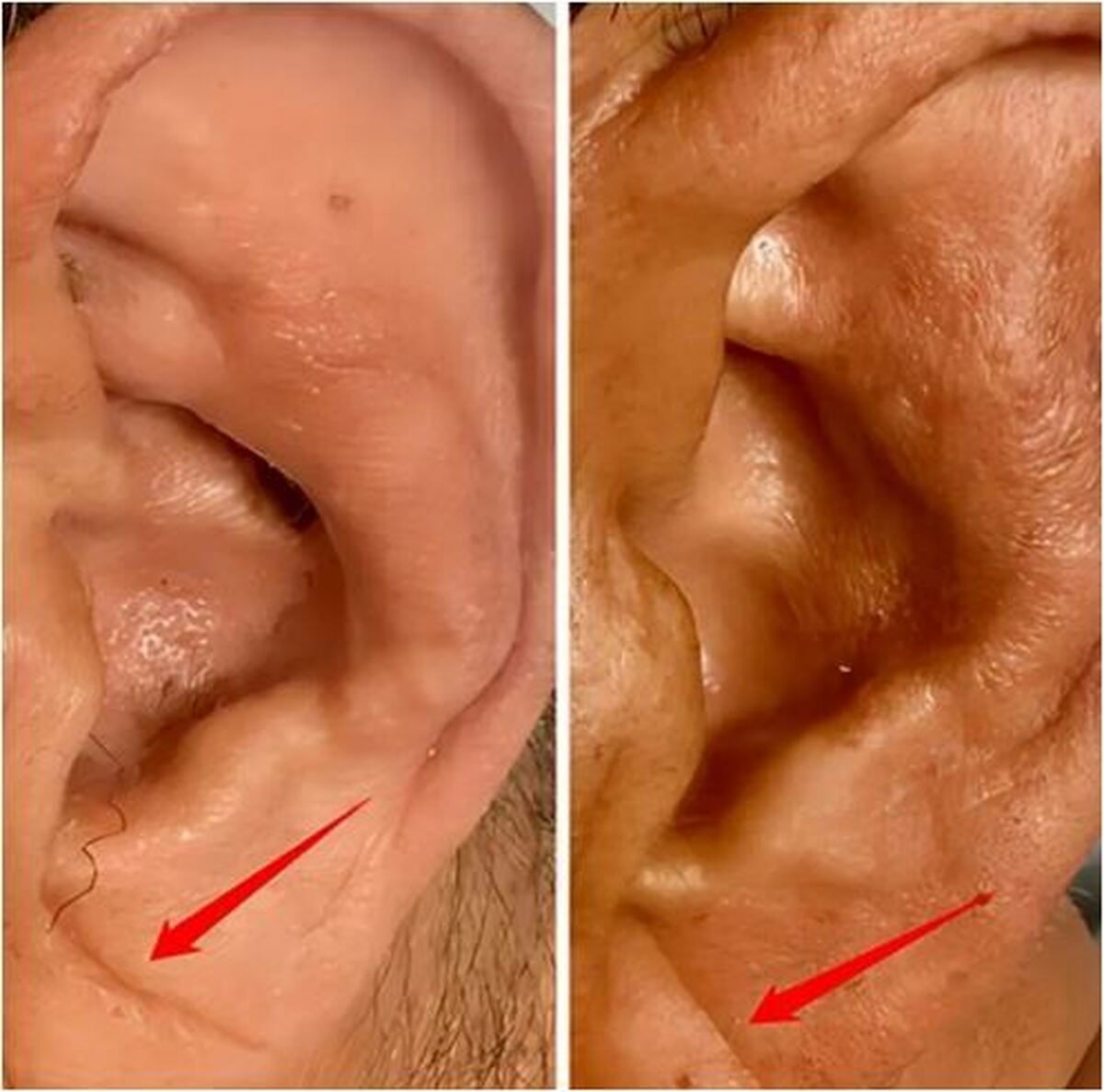 این تغییرات در لاله گوش‌ها را جدی بگیرید