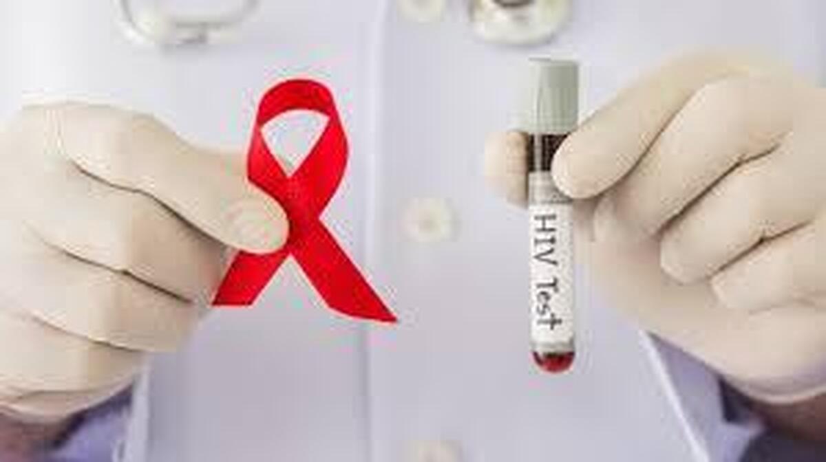تعاملات پروتئینی ناشناخته قبلی می‌تواند منجر به بهبود درمان HIV شود