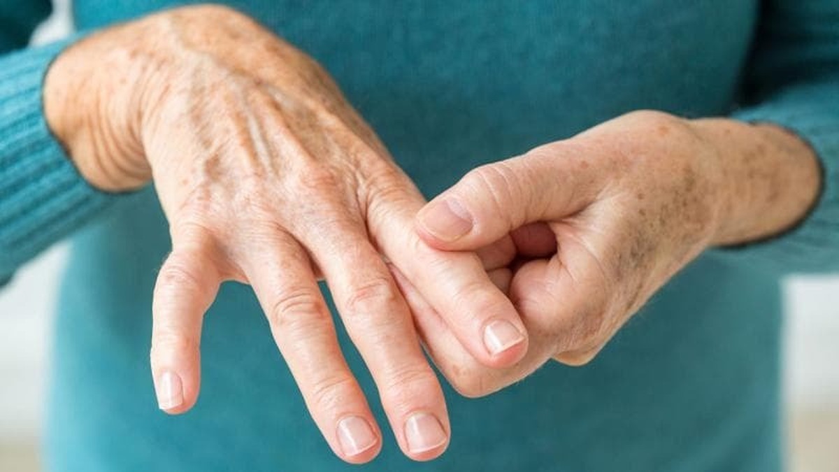 آرتریت روماتوئید با افزایش خطر نارسایی قلبی مرتبط است