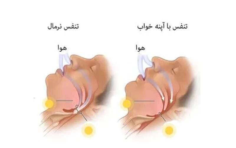 اگر شماهم با سردرد روز خود را شروع می‌کنید بخوانید!