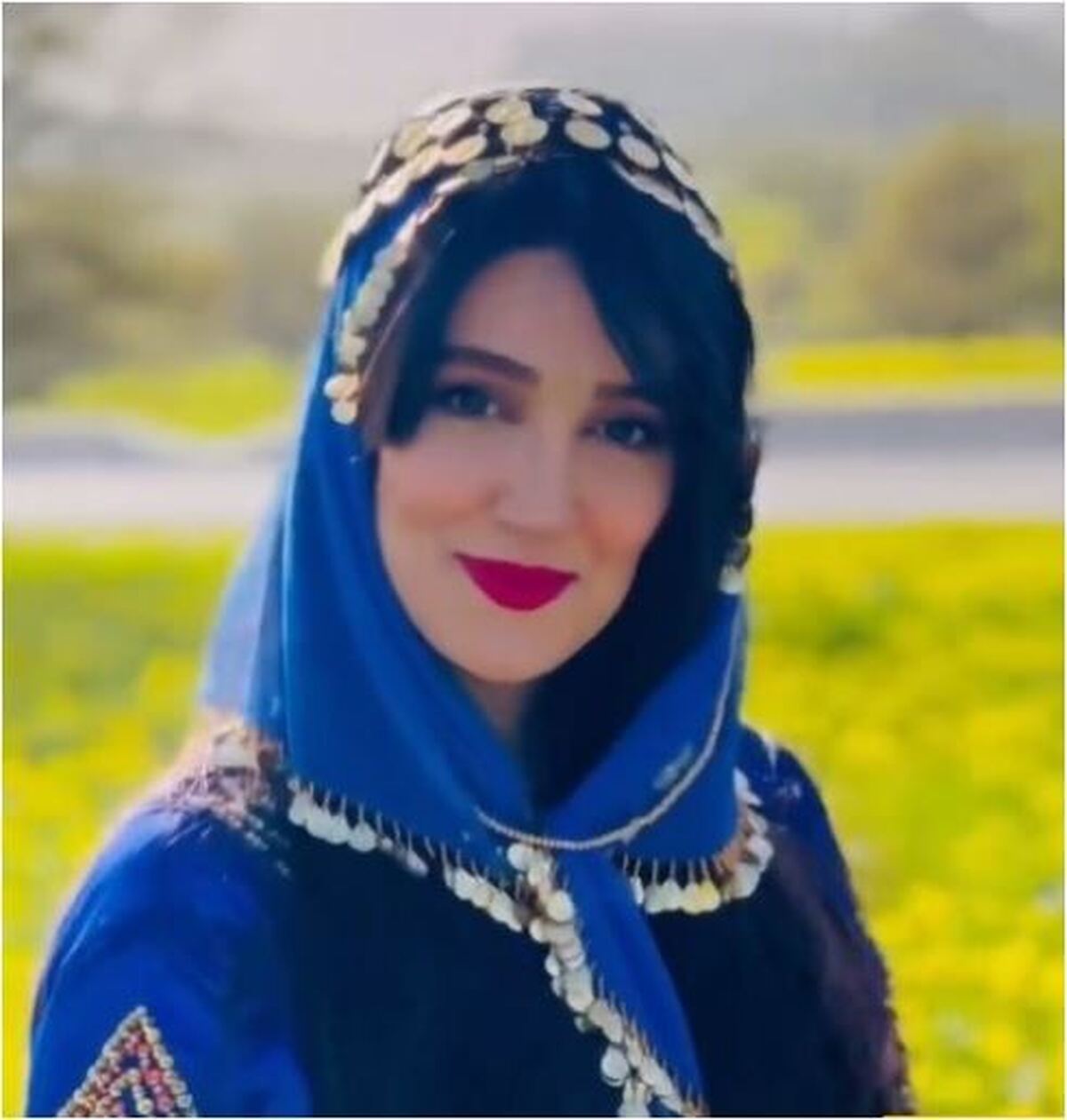 هوژان سریال ناریا مخالف سفت و سخت بوتاکس زدن!