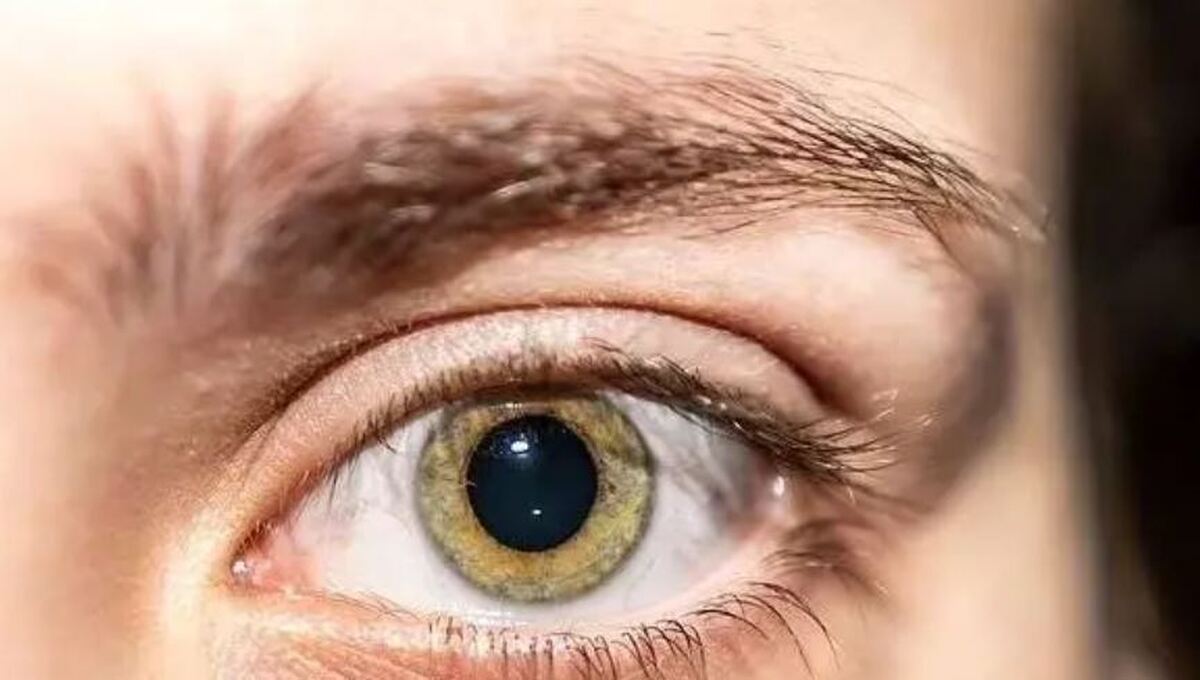 مراقبت‌های ضروری از چشم‌ها در شرایط جنگی را بدانید