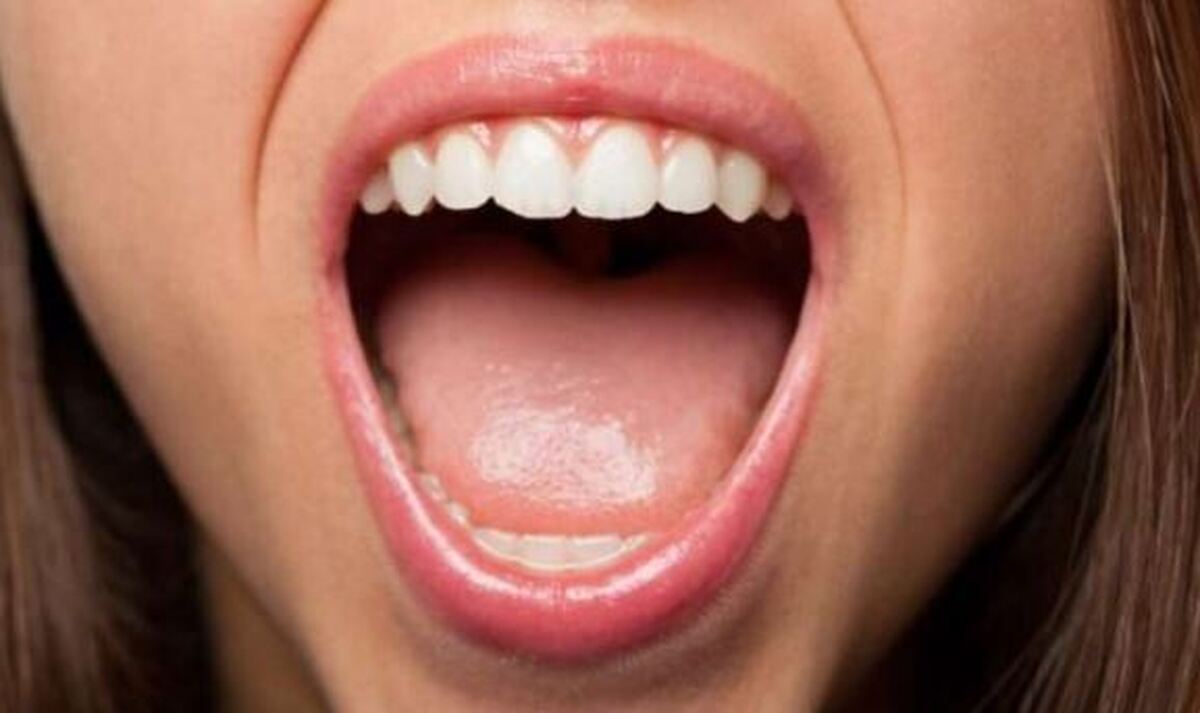 اگر دچار سوزش زبان شده‌اید بخوانید!