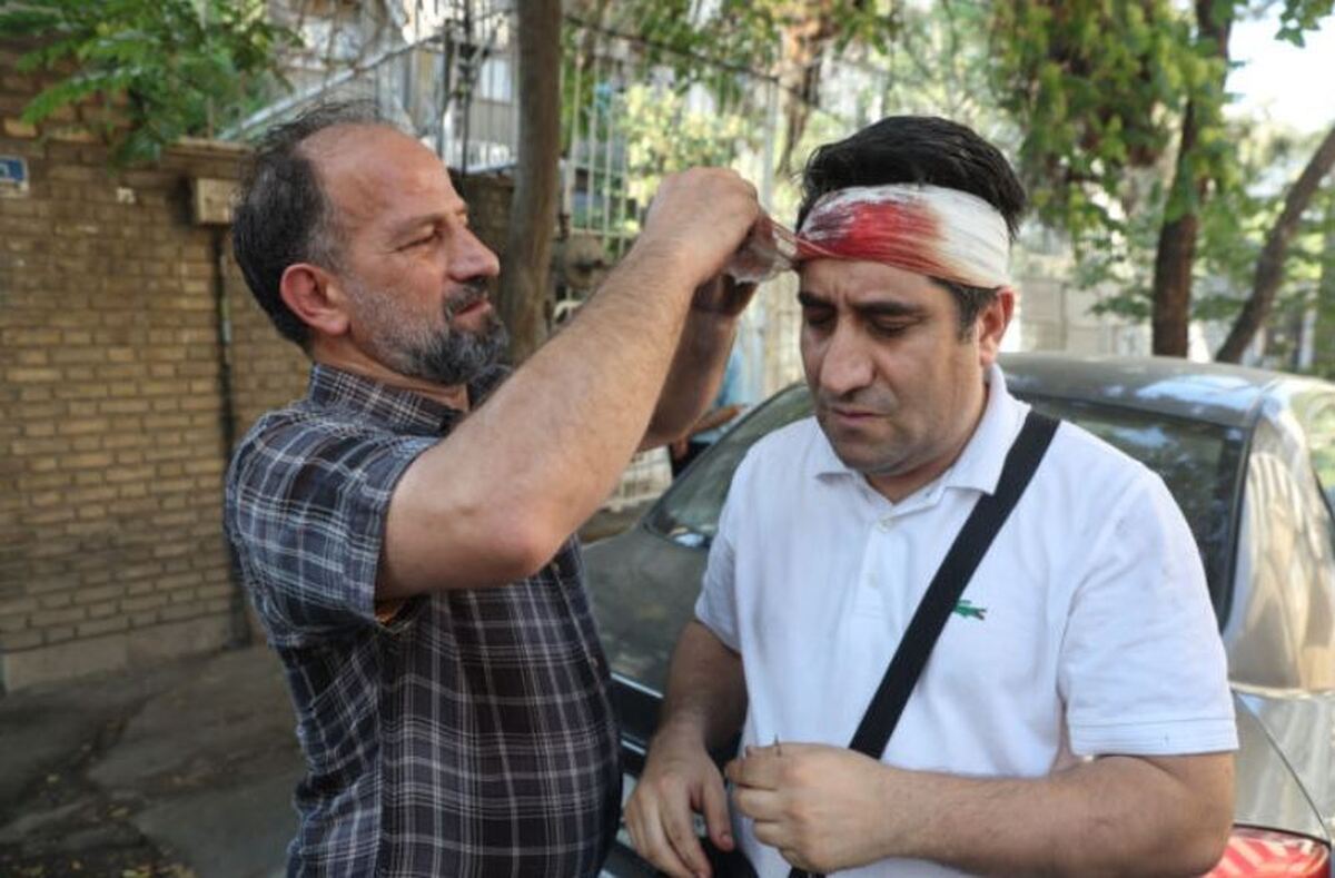 اقدامات پزشکی که در مواجه با افرادی که دچار سوختگی شدند باید بدانید