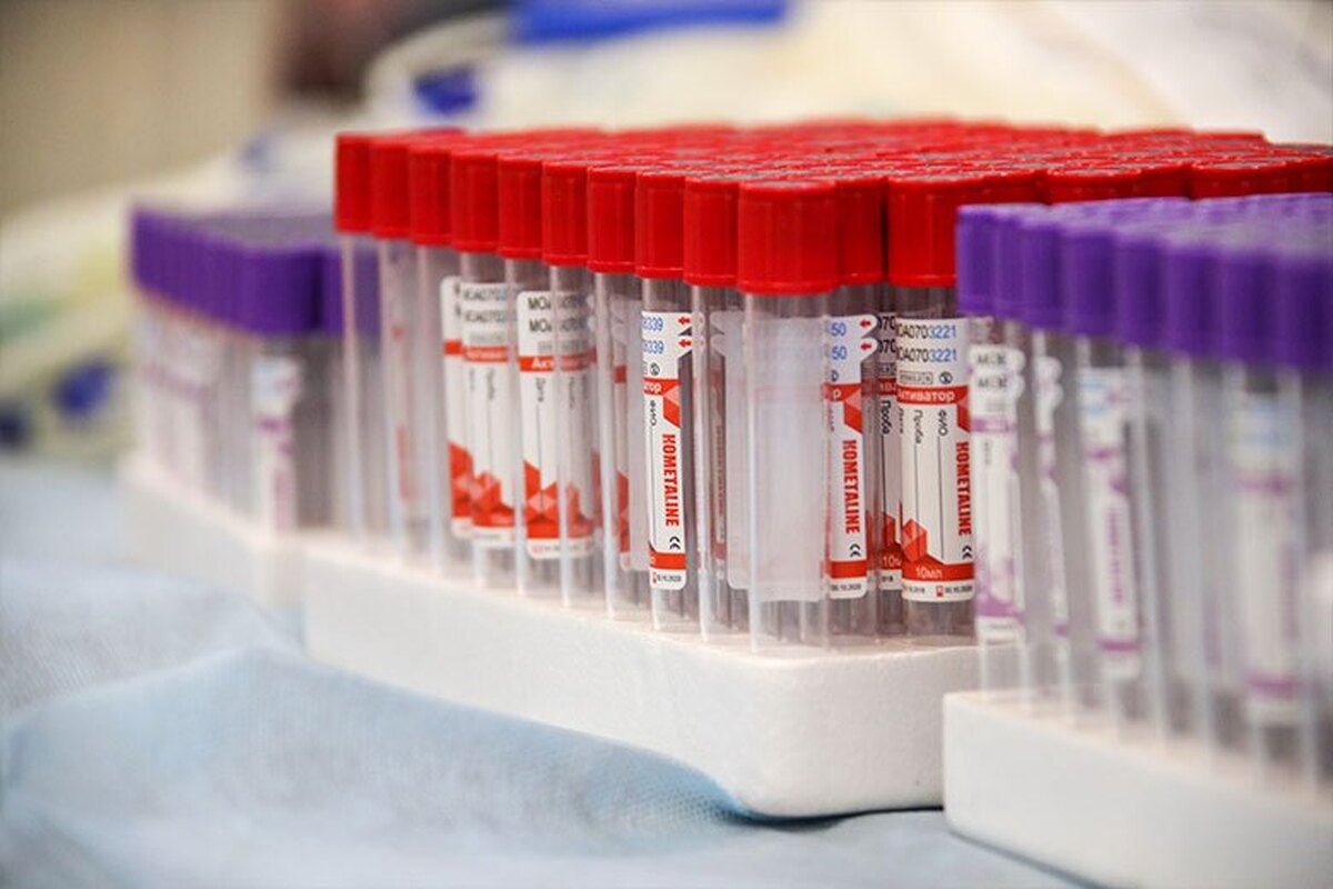 اوکراین بدون مشاور آمریکایی HIV باقی خواهد ماند