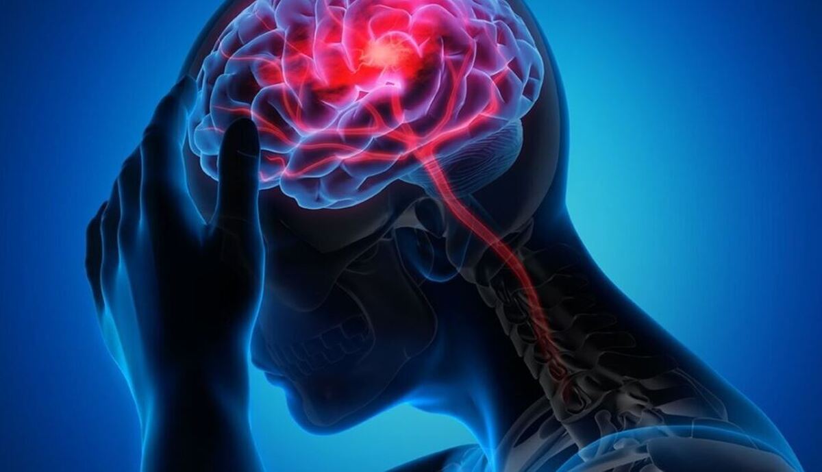 مراقب حس خستگی دائمی تان باشید، سکته مغزی در کمین است!