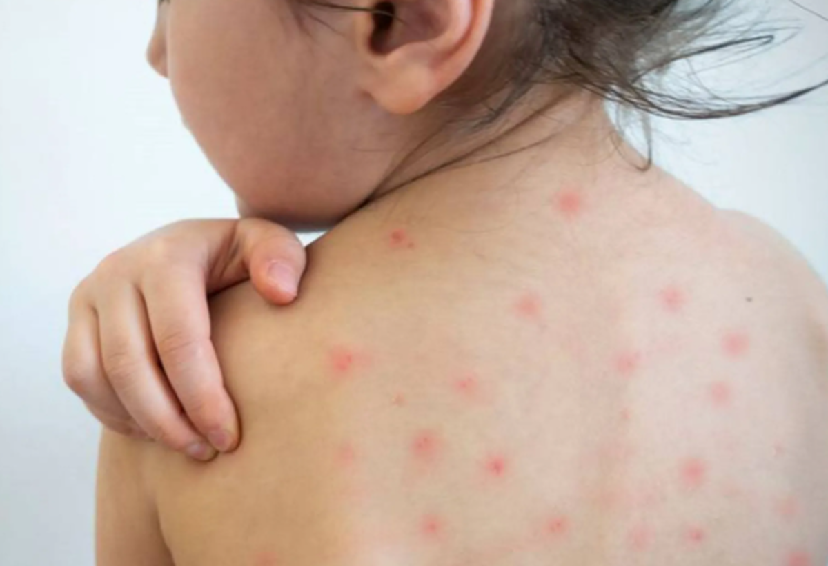 چرا دیدگاه عمومی راجب واکسیناسیون تغییر کرده است؟