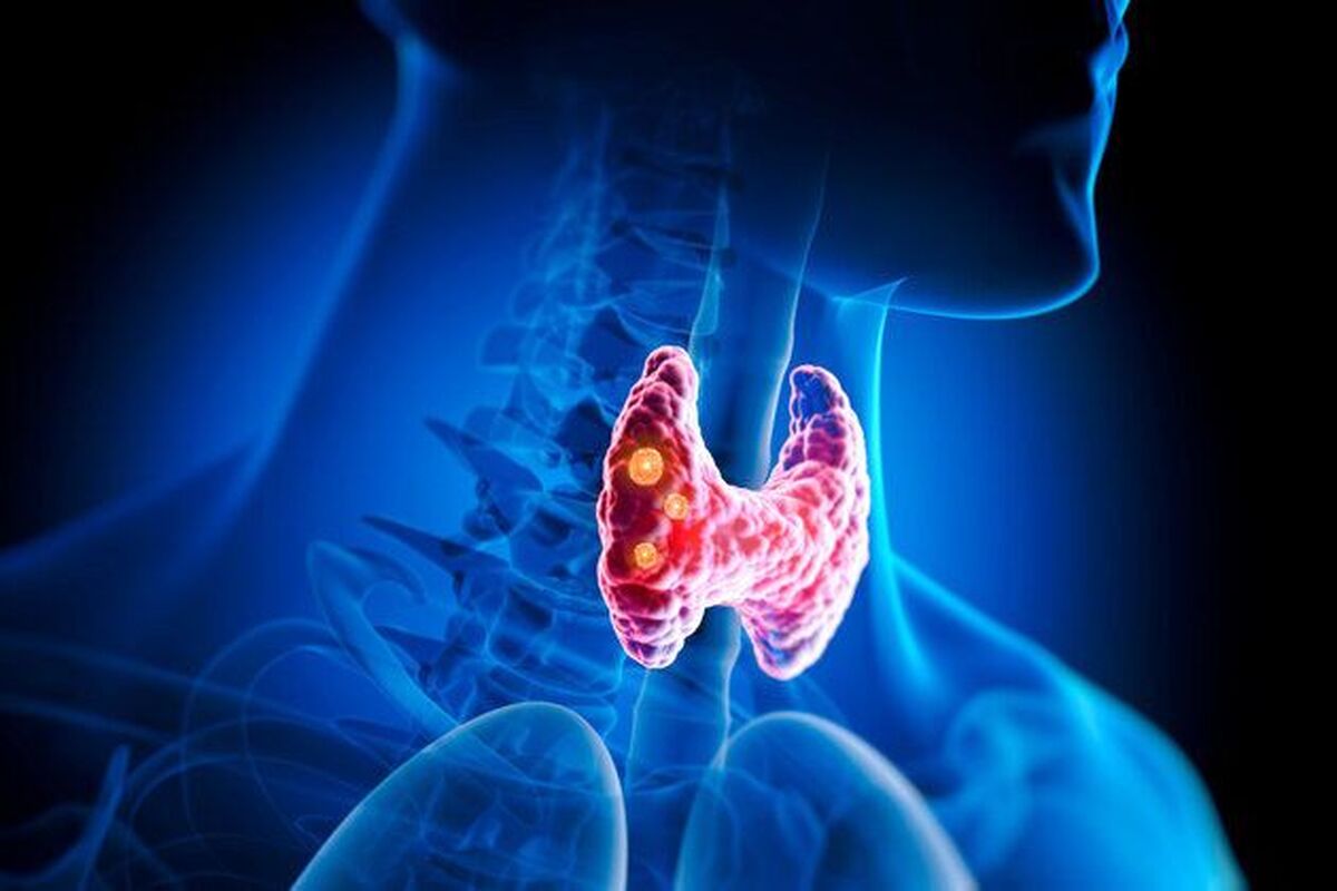 اهمیت غده تیروئید در سلامت بدن