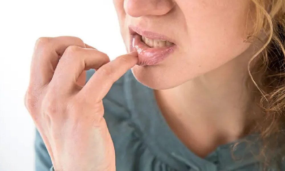 آفت دهان را چگونه از بین ببریم؟