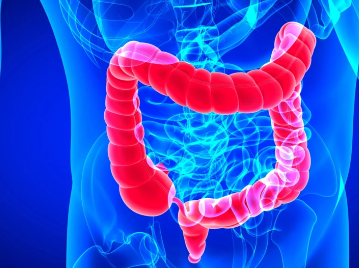 چگونه از ابتلا به بیماری دیورتیکولیت پیشگیری کنیم؟