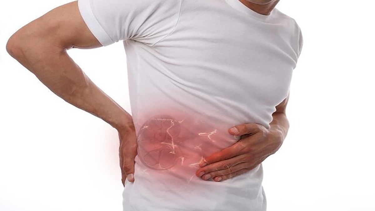 چگونه مانع ابتلا به سنگ‌کلیه شویم؟