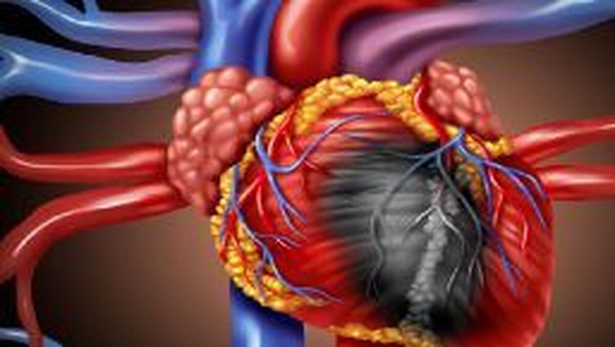 علائم اولیه بیماری چربی قلب