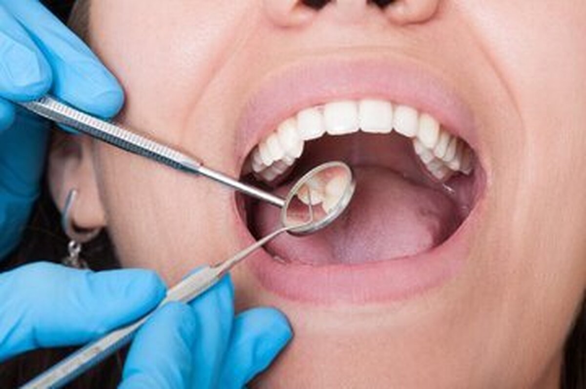 آیا استرس مداوم روی سلامت دهان و دندان تاثیر می‌گذارد؟